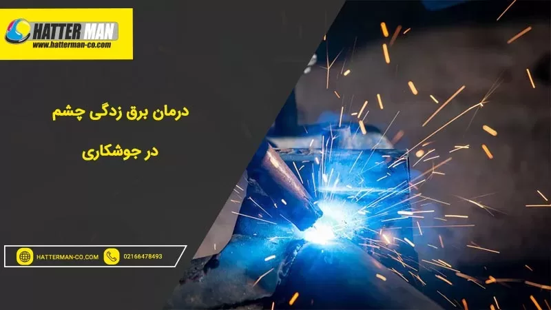 درمان برق زدگی چشم در جوشکاری